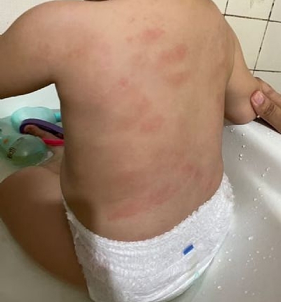 Laudo confirma que bebê de 1 ano foi agredido em creche