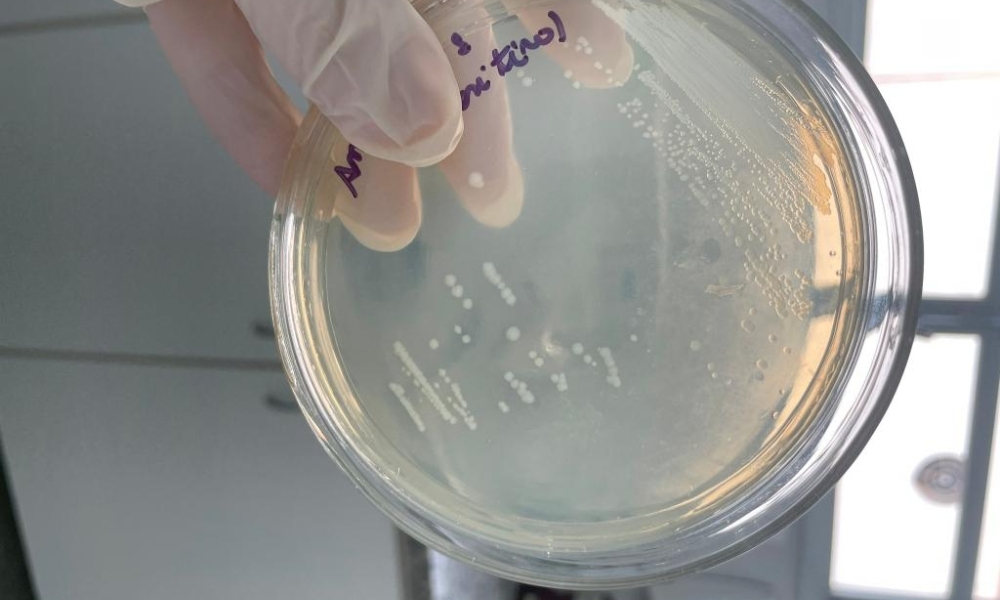 Pesquisadores em MT desenvolvem novo detector de anticorpos contra vírus da encefalite de Saint Louis na Amazônia