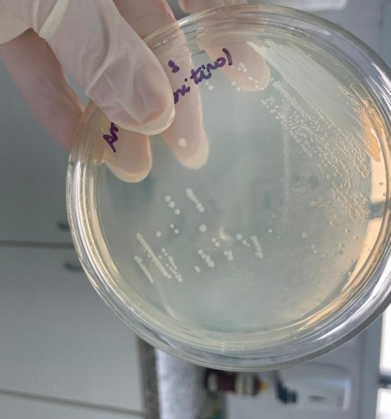 Pesquisadores em MT desenvolvem novo detector de anticorpos contra vírus da encefalite de Saint Louis na Amazônia