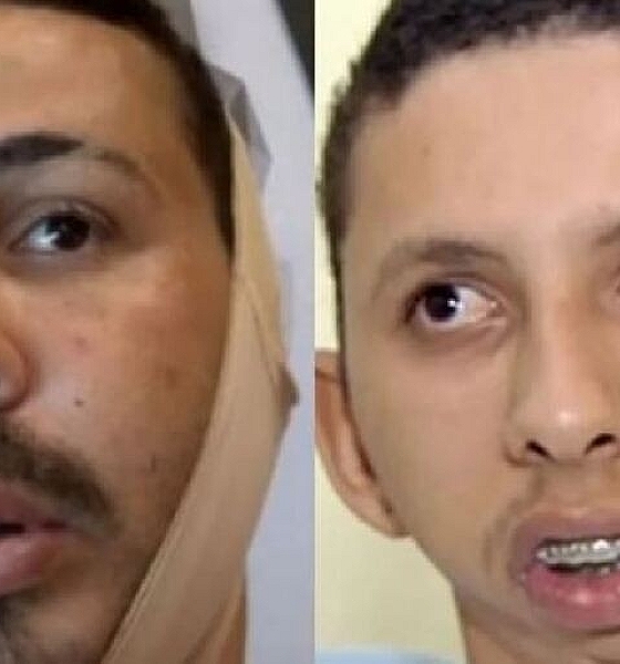 Carlinhos Maia é condenado a pagar R$ 200 mil por danos morais a jovem cuiabano com má-formação facial