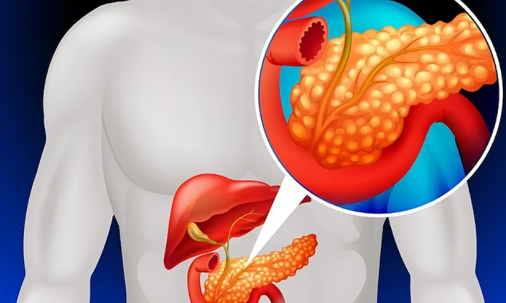 Câncer de pâncreas: entenda a doença que levou Edu Guedes à cirurgia