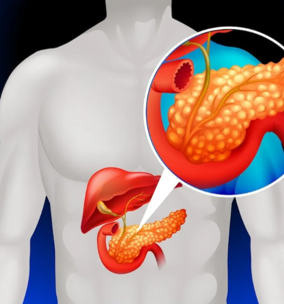 Câncer de pâncreas: entenda a doença que levou Edu Guedes à cirurgia