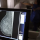 Desigualdade no acesso a mamgrafos compromete diagnstico precoce do cncer de mama