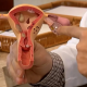 Endometriose: identificando sintomas e opes de tratamento