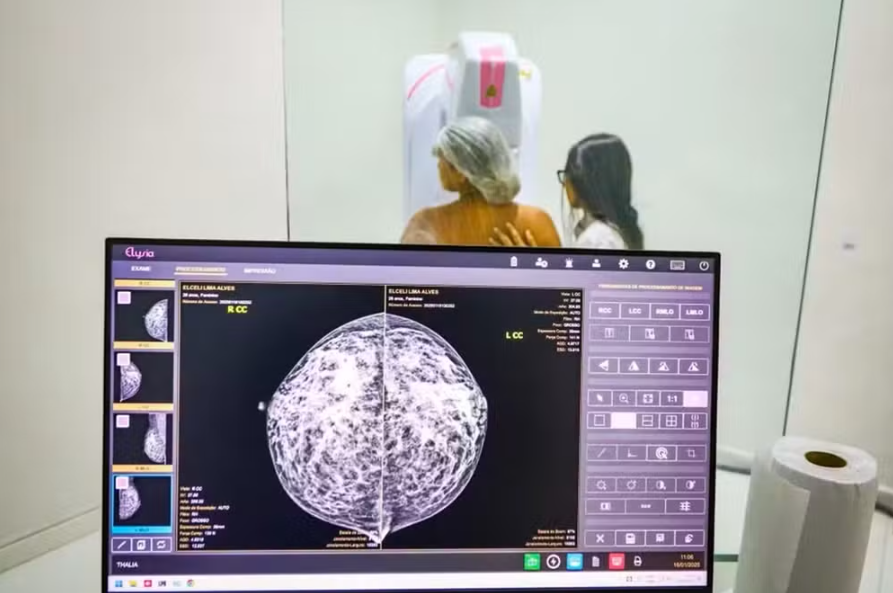 Mulheres a partir de 40 anos ter�o acesso ampliado � mamografia no SUS