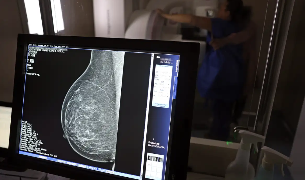 Desigualdade no acesso a mamgrafos compromete diagnstico precoce do cncer de mama