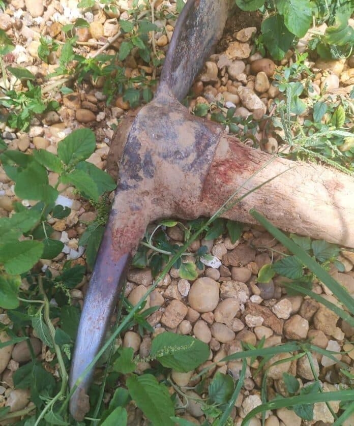 Pedreiro morre aps ser brutalmente agredido com picareta