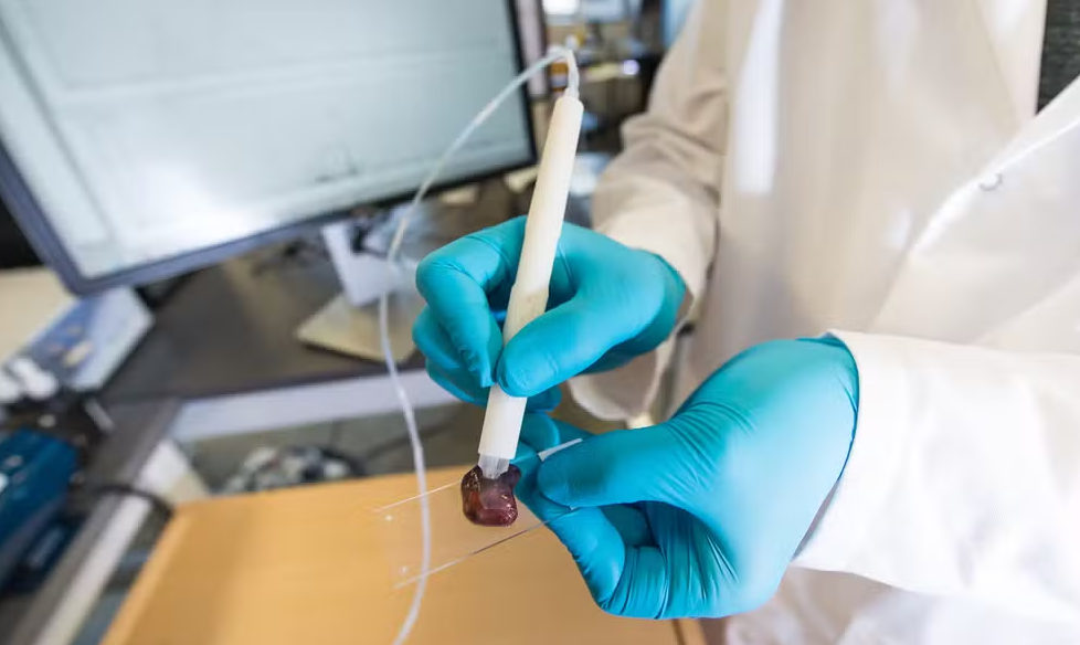 Cientista brasileira desenvolve caneta que detecta c�ncer em apenas 10 segundos