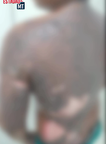 Grupo de adolescentes chama menino de 13 anos para brincar, ateia fogo e filma ataque em Sorriso (V�deo)