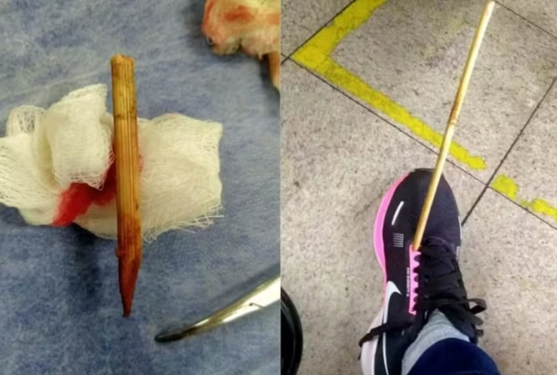 Mulher � atingida por �flecha� enquanto caminhava pela rua em BH