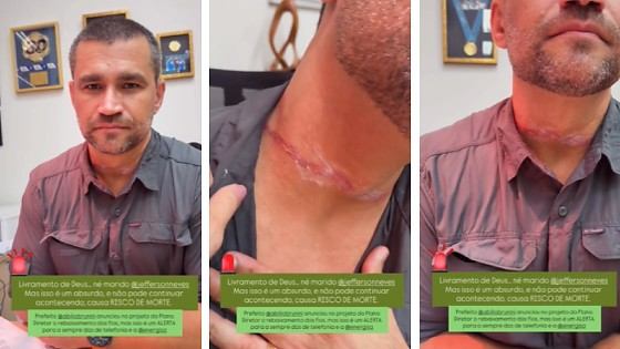 Fio solto atinge pesco�o de secret�rio e exp�e risco grave em Cuiab� (V�deo)