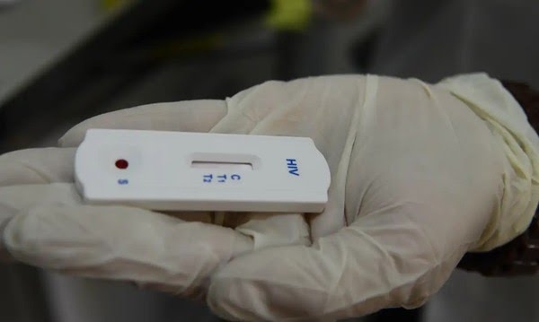 Seis transplantados do RJ testam positivo para HIV aps receberem rgo infectado: Situao sem precedentes, diz Secretaria