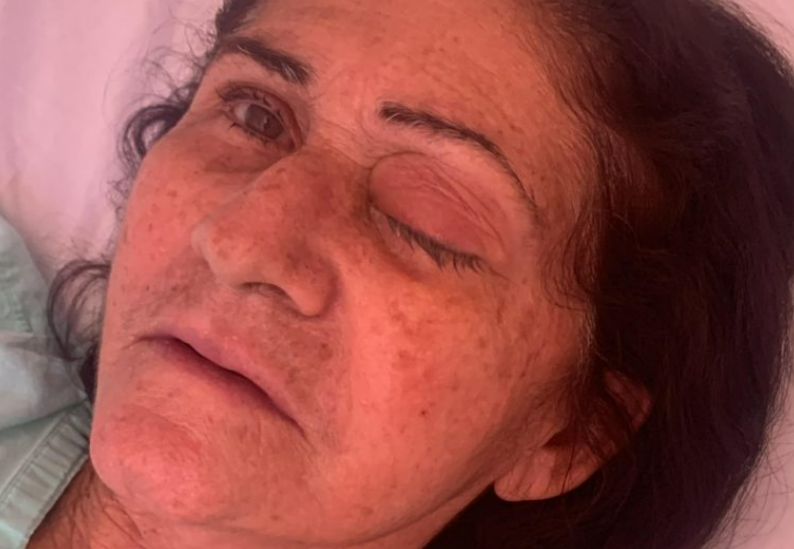 Complica��es ap�s mutir�o de cirurgias de catarata em Parelhas levam 8 pacientes a retirarem globo ocular