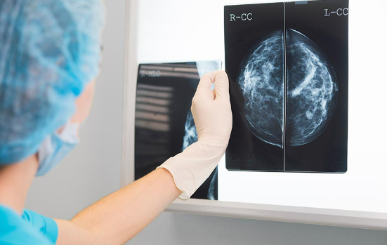 Especialistas reafirmam import�ncia da mamografia na preven��o e diagn�stico precoce do c�ncer de mama