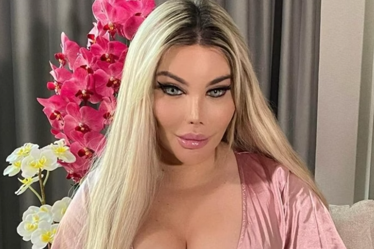 Modelo � hospitalizada com buraco no bumbum ap�s picada de abelha