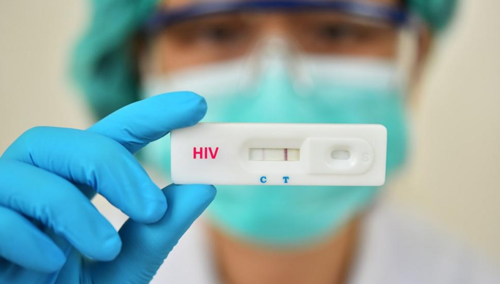 Cermac atendeu 2,3 mil pacientes com HIV e Aids em 12 meses