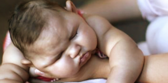 C�mara aprova pens�o vital�cia para pessoas com microcefalia causada pelo Zika