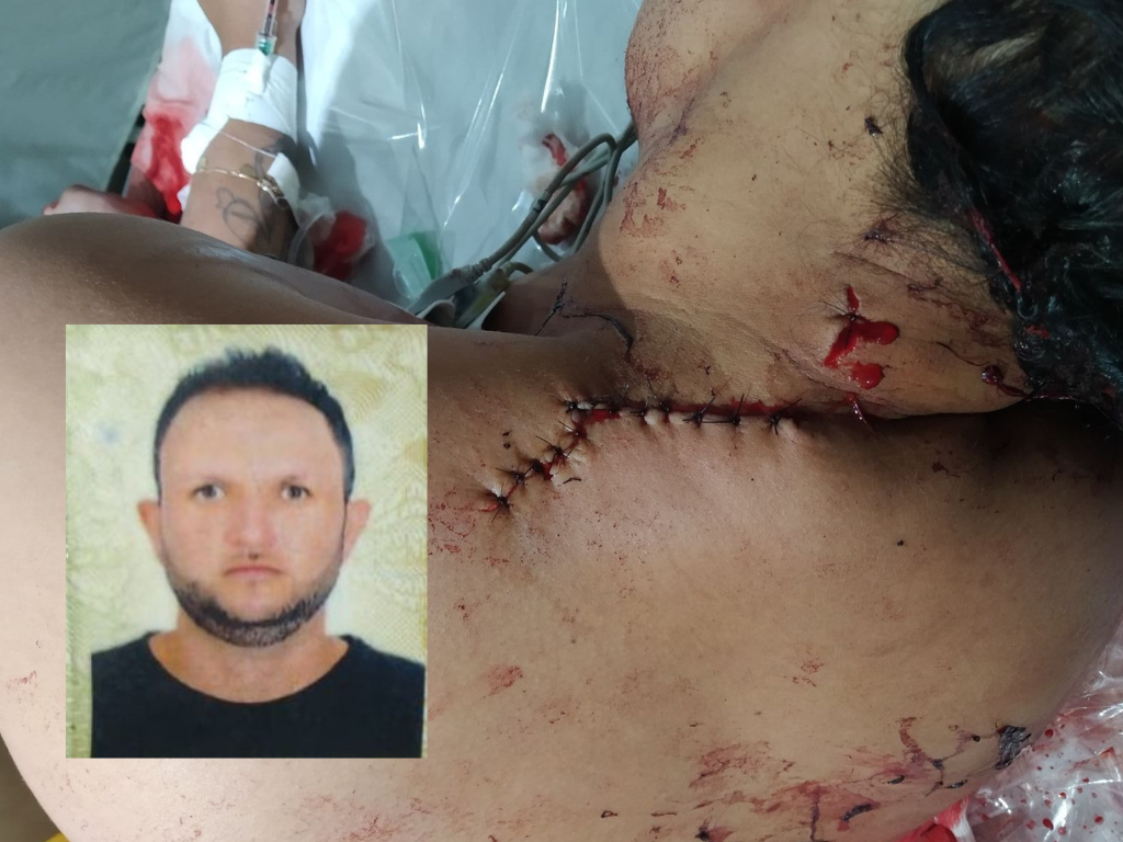 Mulher  golpeada com facadas pelo esposo em Jaciara