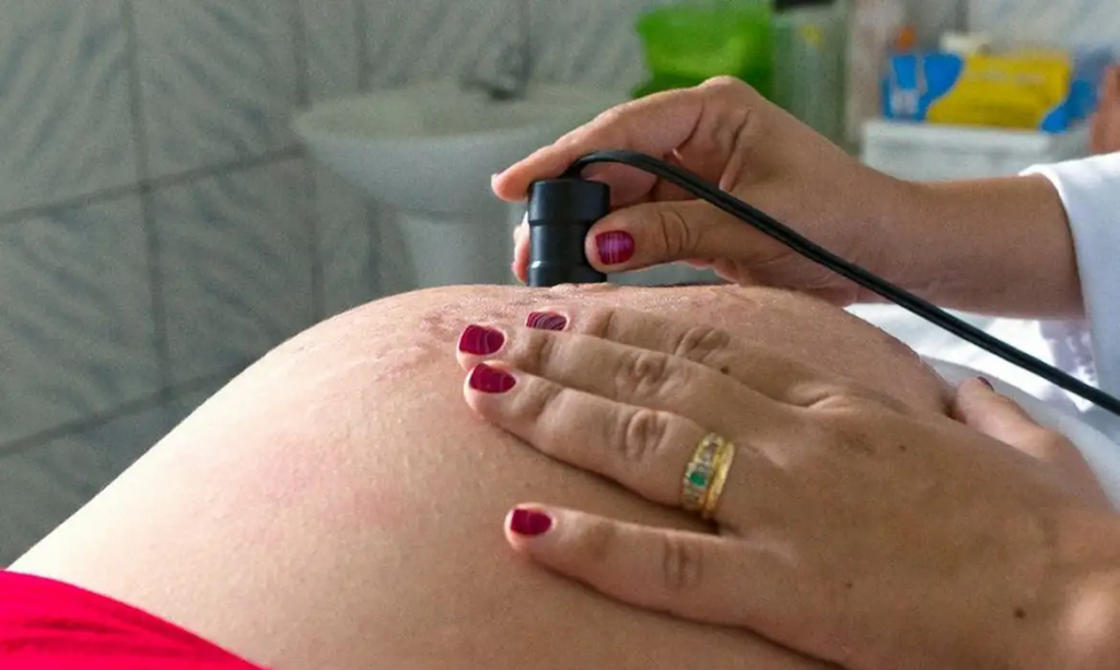Sa�de recomenda c�lcio para todas as gestantes para prevenir ecl�mpsia