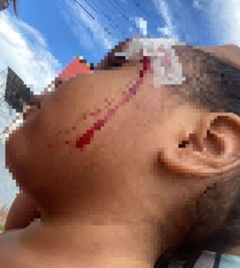 Mulher � presa em flagrante por agredir filha de tr�s anos com cabo de vassoura em V�rzea Grande