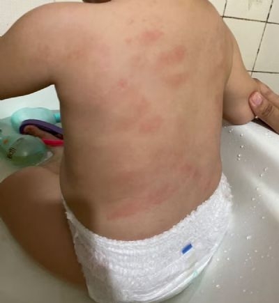 Laudo confirma que beb� de 1 ano foi agredido em creche