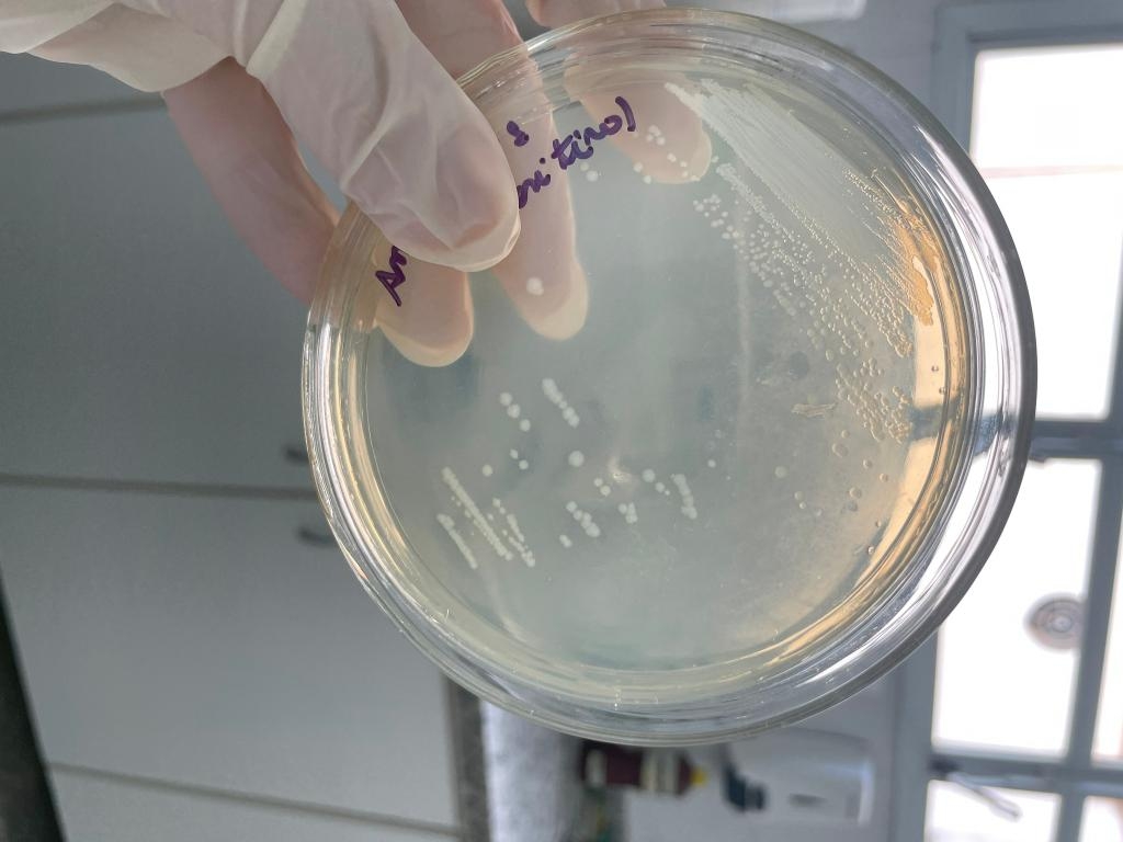 Pesquisadores em MT desenvolvem novo detector de anticorpos contra v�rus da encefalite de Saint Louis na Amaz�nia