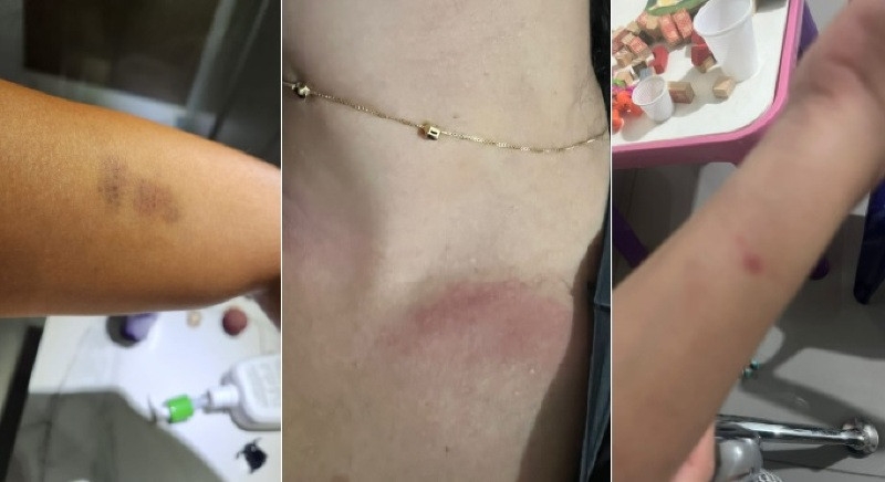 Mulher denuncia agress�es do noivo ap�s discuss�o em Cuiab�